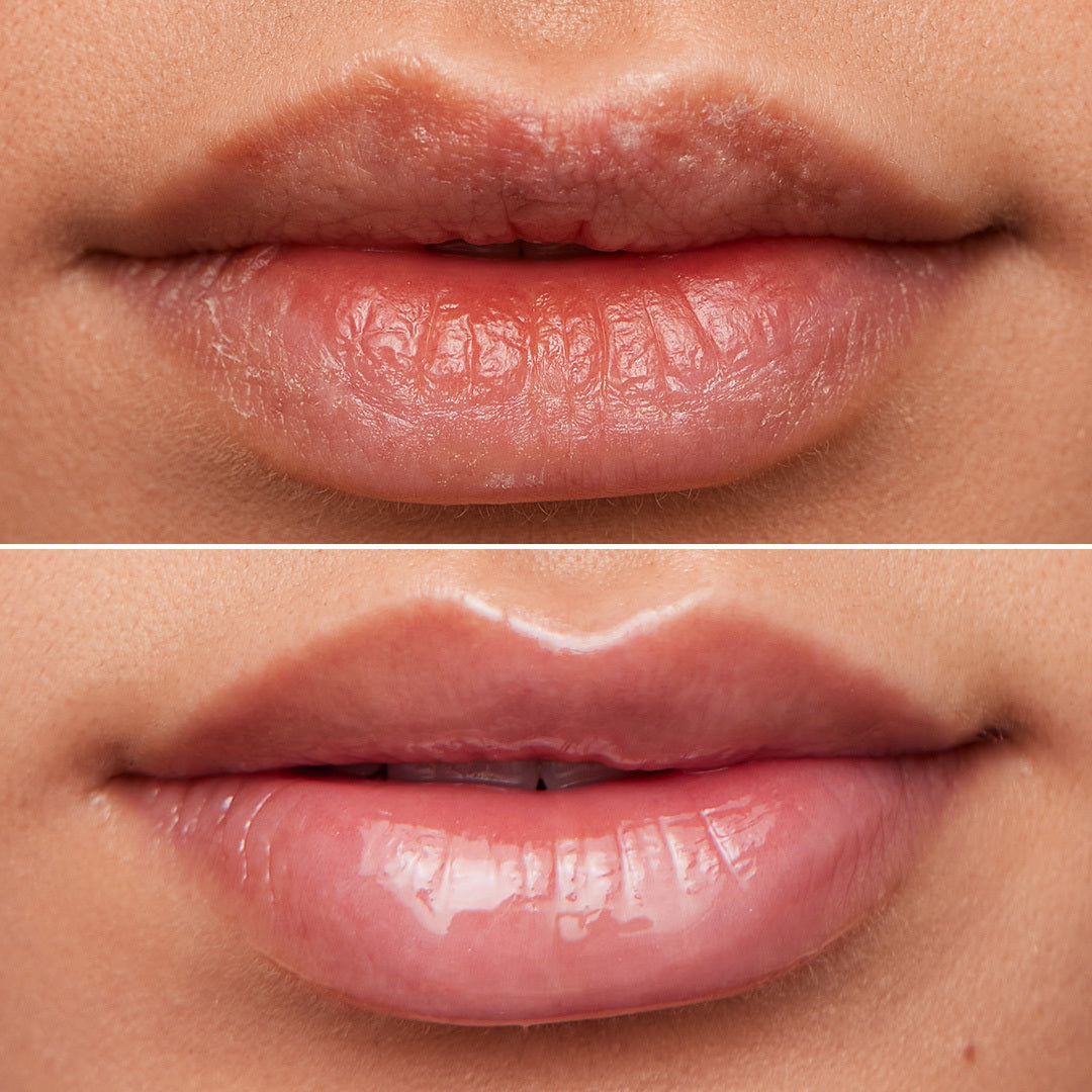Lip Rehab Serum Oil - Image 9